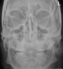 SPORK, NICO - 22.03.1976 - 02.08.2022 - Rö NNH - 16:50:05 - SKULL